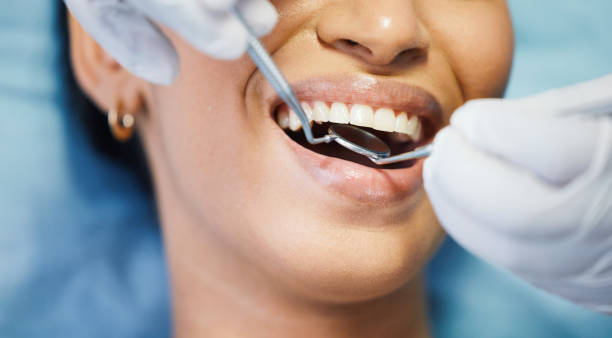 Best Emergency Wisdom Teeth Removal in Oronoco, MN
